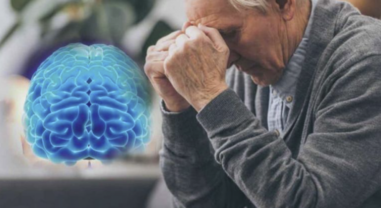 Alzheimer